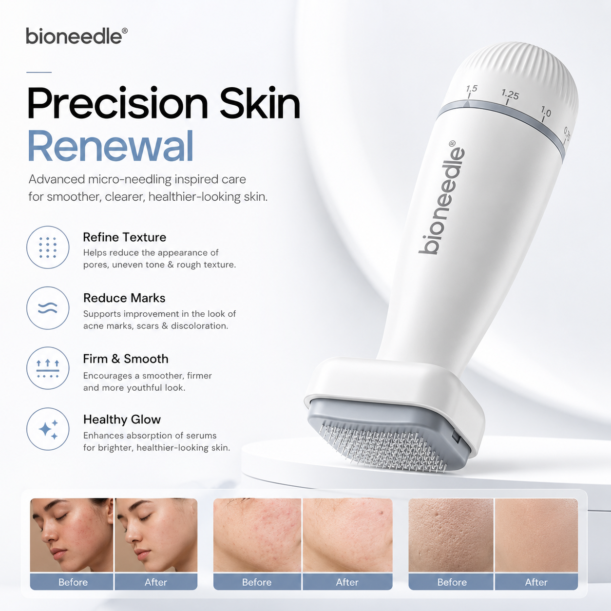 BioNeedle™ Precision Roller